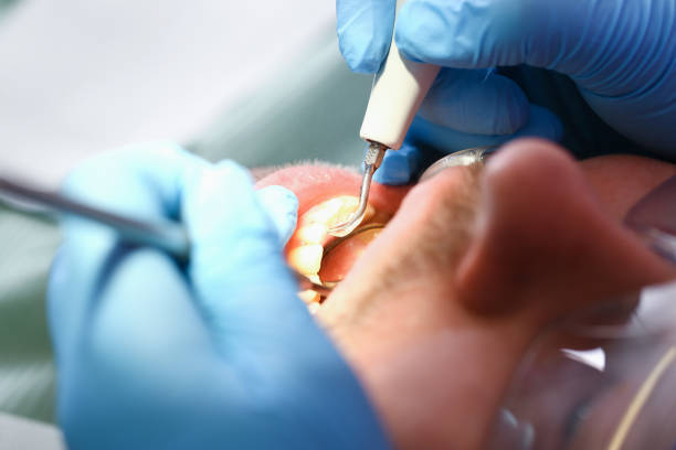 Best Emergency TMJ Treatment in Union City, OK