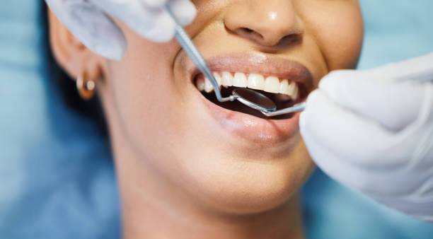 Best Same-Day Emergency Dental Services in Union City, OK